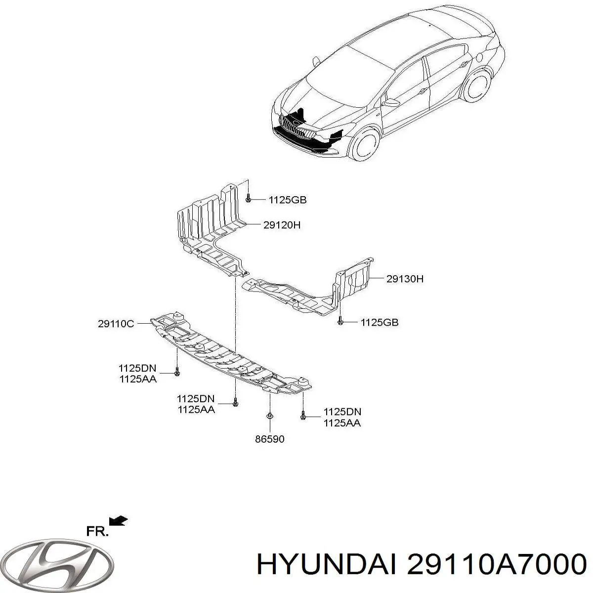  Protección motor delantera para KIA Cerato 